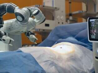 AI robot performing an operation
