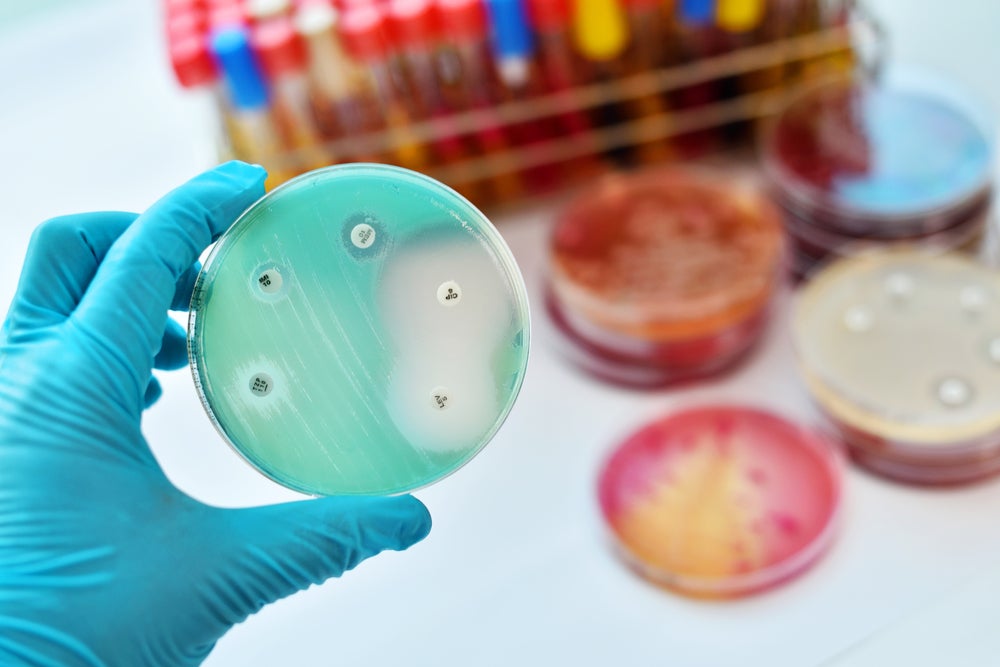A petri dish testing antimicrobial resistance